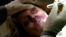 Fringe-1x02-The-Same-Old-Story_323