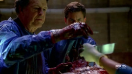 Fringe-1x13-The-Transformation_136