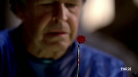 Fringe-1x13-The-Transformation_139